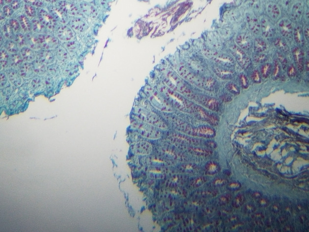 Simple Columnar Epithelium Slides - Simple Columnar Epithelium 04 40X